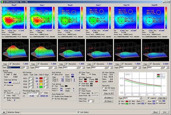 Grid Breast Viewer